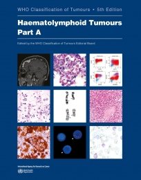 WHO Classification on Tumours Haematolymphoid Tumours Part A/B