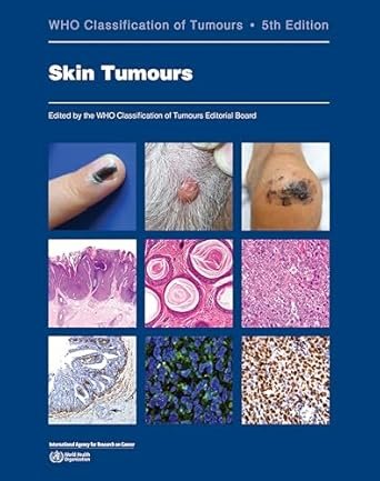 WHO CLASSIFICATION ON TUMOURS  SKIN TUMOURS  5° Edizione in 2 parti