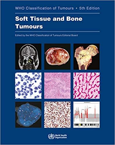 WHO Classification Tumours. Soft Tissue and Bone Tumours