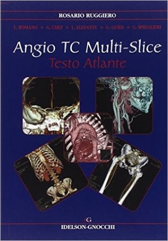 Angio TC multi-slice. Testo atlante