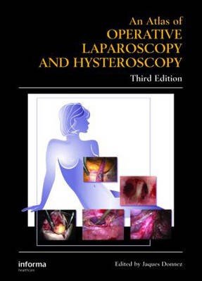 Atlas of Operative Laparoscopy and Hysteroscopy