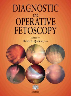 Diagnostic and Operative Fetoscopy
