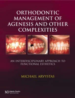 Orthodontic Management of Agenesis and Other Complexities