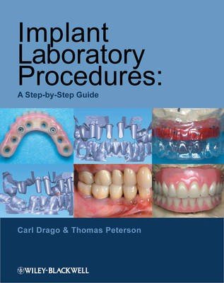 Implant Laboratory Procedures