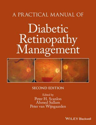 A Practical Manual of Diabetic Retinopathy Management