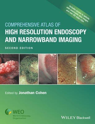 Comprehensive Atlas of High Resolution Endoscopy and Narrowband Imaging