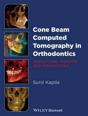 Cone Beam Computed Tomography in Orthodontics
