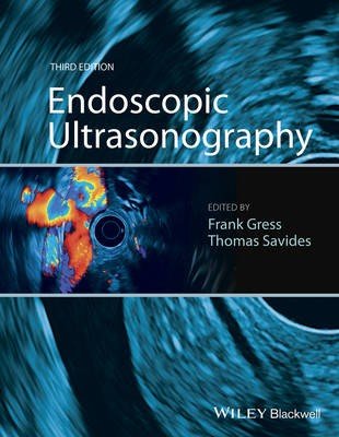 Endoscopic Ultrasonography