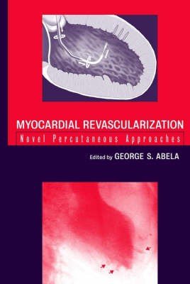 Myocardial Revascularization
