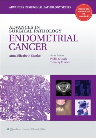 Endometrial cancer 