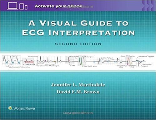 A Visual Guide to ECG Interpretation