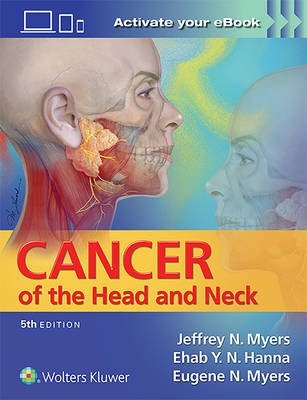 Cancer of the Head and Neck