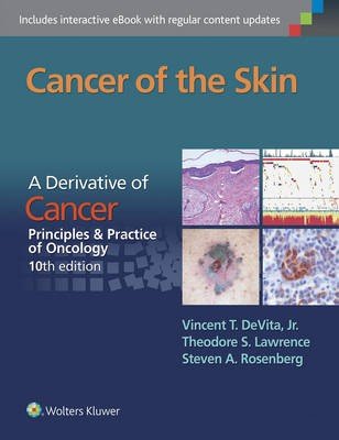 Cancer of the Skin