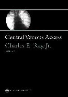 Central Venous Access