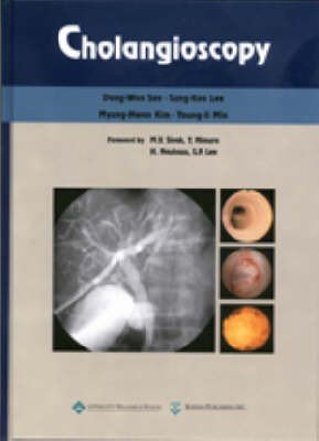 Cholangioscopy