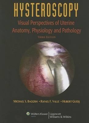 Hysteroscopy