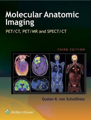Molecular Anatomic Imaging