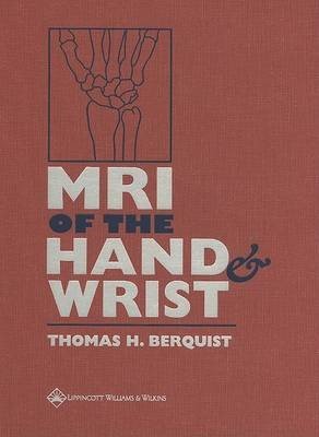 MRI of the Hand and Wrist