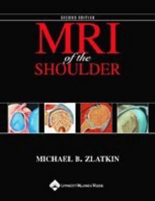 MRI of the Shoulder