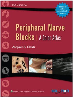 Peripheral Nerve Blocks