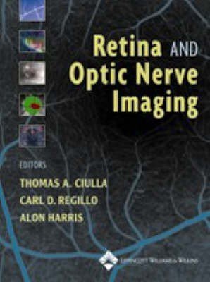 Retina and Optic Nerve Imaging