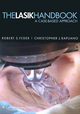 The LASIK Handbook