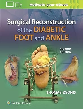 Surgical Reconstruction of the Diabetic Foot and Ankle