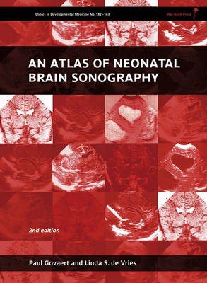 Atlas of Neonatal Brain Sonography