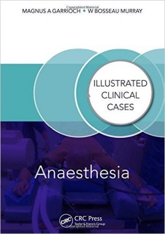 Anaesthesia