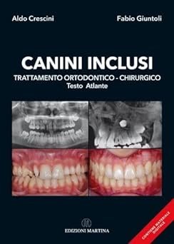 Canini inclusiu. Trattamento ortodontico-chirurgico. Testo atlante