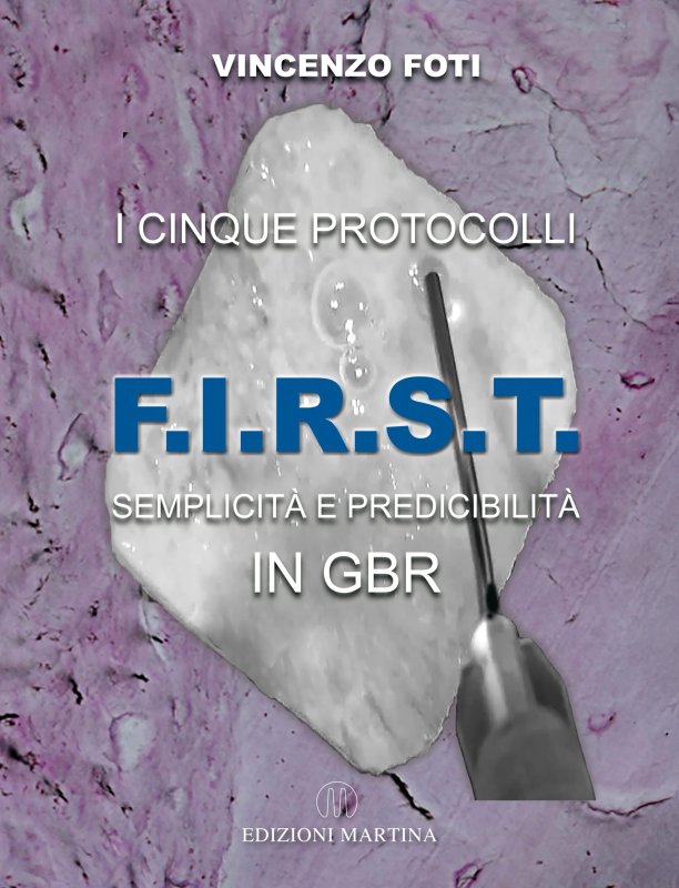 I cinque protocolli F.I.R.S.T. - Semplicità e predicibilità in GBR