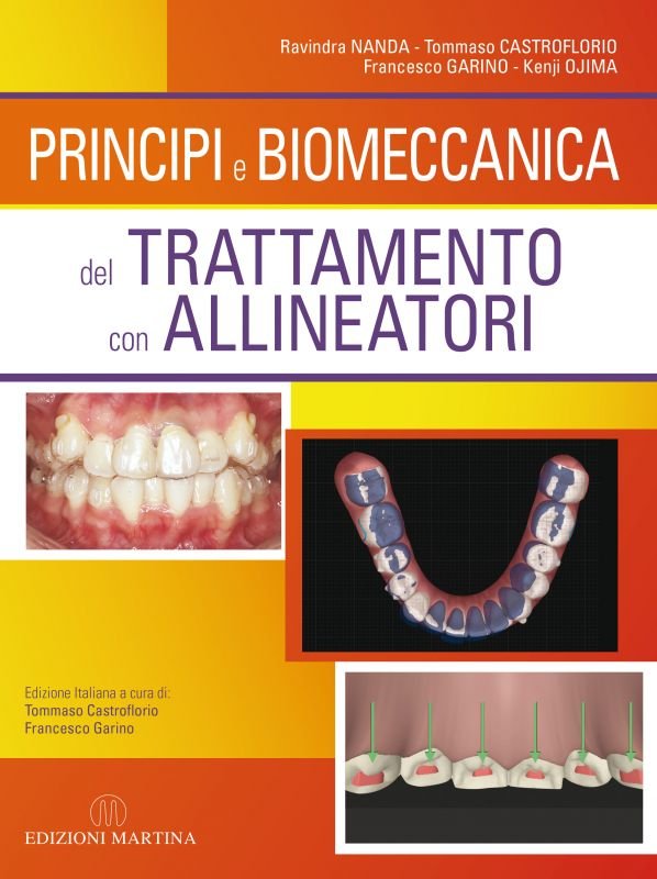 Principi e biomeccanica del trattamento con allineatori