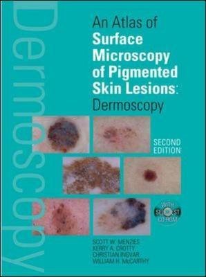 An Atlas of Surface Microscopy of Pigmented Skin Lesions
