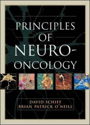 Principles Of Neuro-oncology