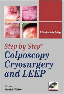 Step-by-step Colposcopy, Cryosurgery, and LEEP