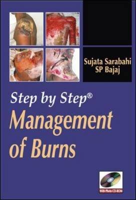Step by Step Management of Burns