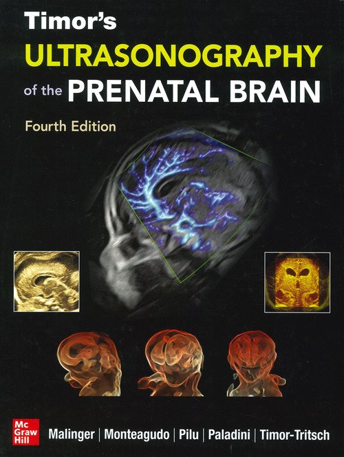 Timor's Ultrasonography of the Prenatal Brain, Fourth Edition