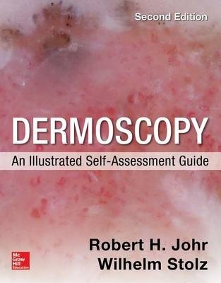 Dermoscopy: an illustrated self-assessment guide