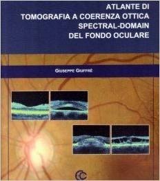 Atlante di Tomografia a coerenza ottica Spectral - Domain del fondo oculare