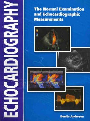 Echocardiography