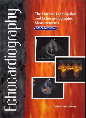 Echocardiography