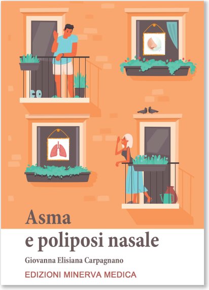 Asma e poliposi nasale