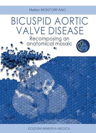 Bicuspid aortic valve disease. Recomposing an anatomical mosaic