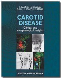 Carotid Disease