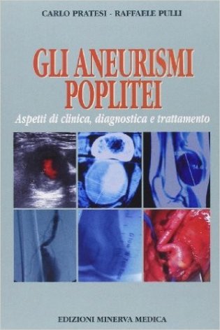 Gli aneurismi poplitei. Aspetti di clinica, diagnostica e trattamento