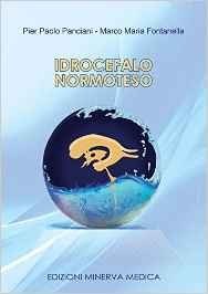 Idrocefalo normoteso