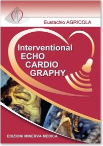 Interventional Echocardiography