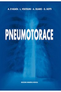 Pneumotorace