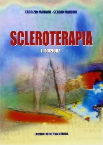 Scleroterapia
