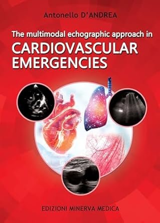 The multimodal echographic approach in cardiovascular emergencies